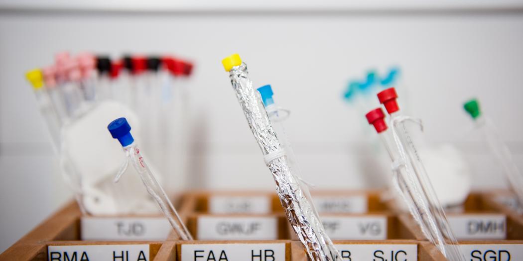A set of glass pipettes with colourful tops and labels sits in a box.