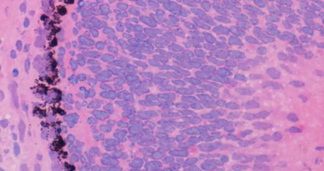Retinal Pigmented Epithelium