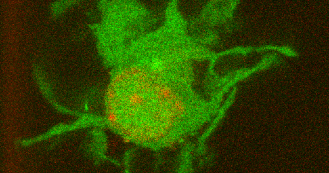 GFP-labelled Dendritic Cell