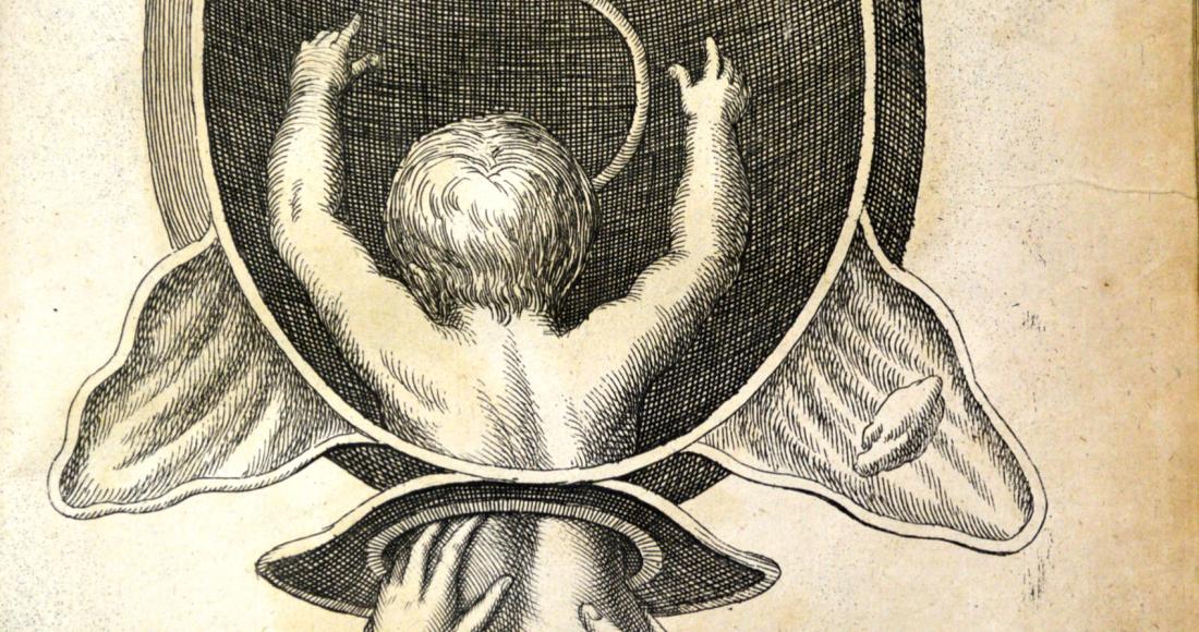 A print from 1690 depicting a baby being guided out of the birth canal.